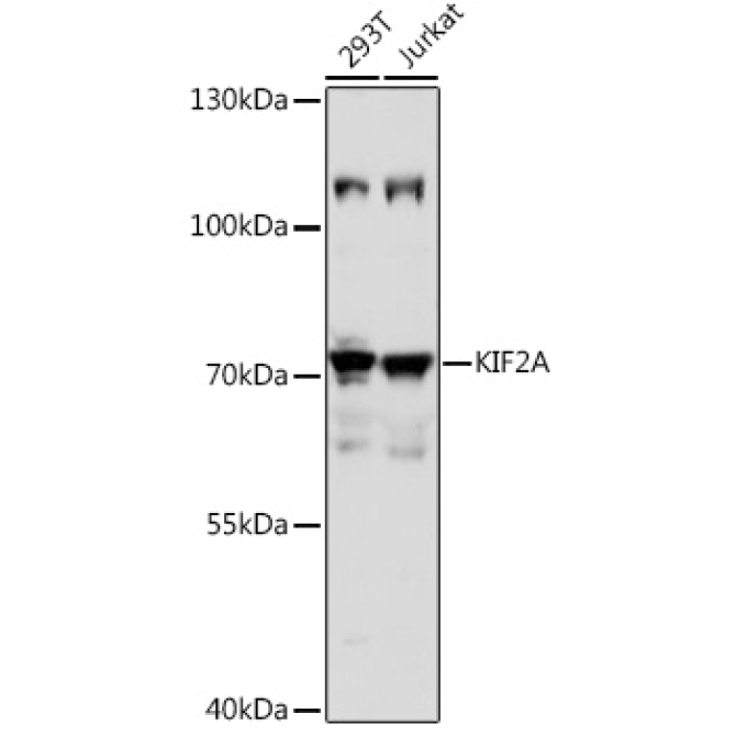 KIF2A Rabbit Polyclonal Antibody