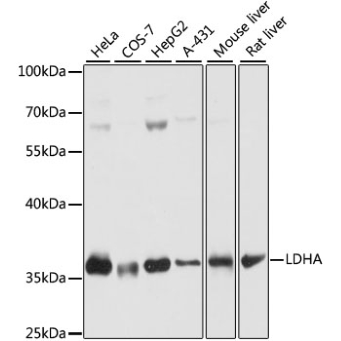 LDHA Rabbit Polyclonal Antibody