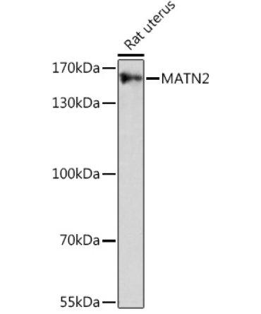 MATN2 Rabbit Polyclonal Antibody