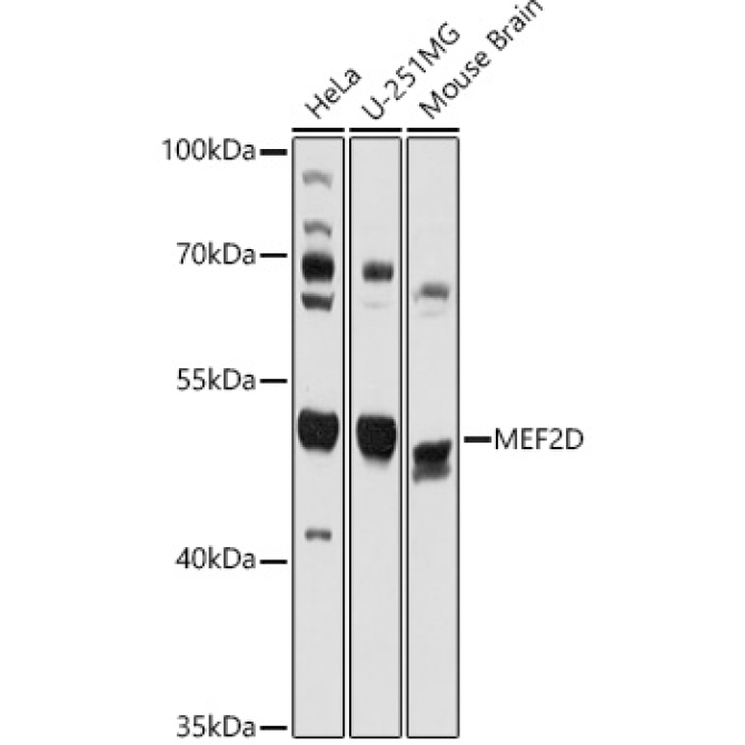 MEF2D Rabbit Polyclonal Antibody