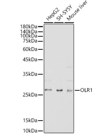 OLR1 Rabbit Polyclonal Antibody