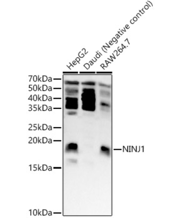 NINJ1 Rabbit Polyclonal Antibody