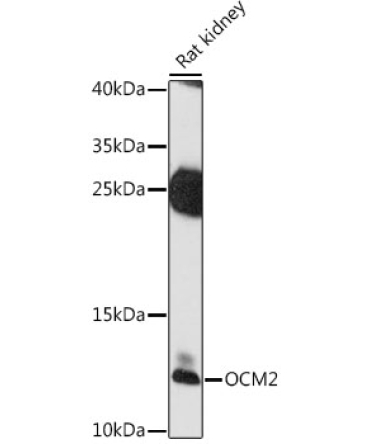 OCM2 Rabbit Polyclonal Antibody