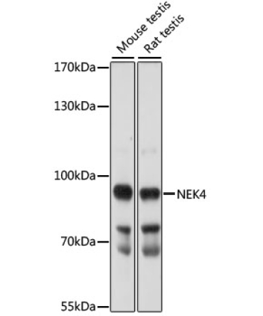 NEK4 Rabbit Polyclonal Antibody