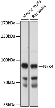 NEK4 Rabbit Polyclonal Antibody