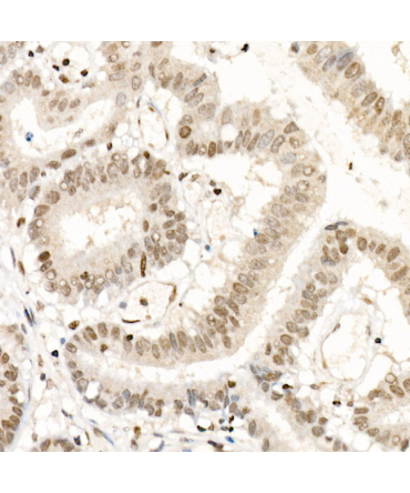 NR2F1 Rabbit Polyclonal Antibody