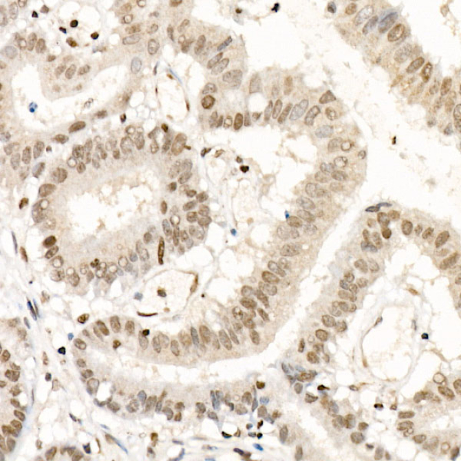 NR2F1 Rabbit Polyclonal Antibody