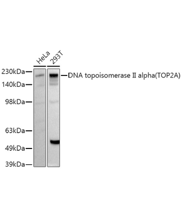DNA topoisomerase II alpha (TOP2A) Rabbit Polyclonal Antibody