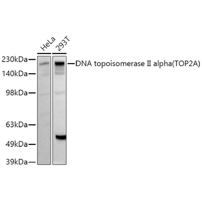 DNA topoisomerase II alpha (TOP2A) Rabbit Polyclonal Antibody