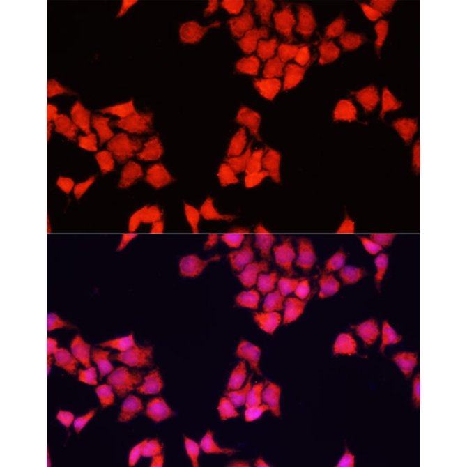 FXR1 Rabbit Polyclonal Antibody