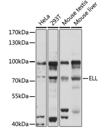 ELL Rabbit Polyclonal Antibody