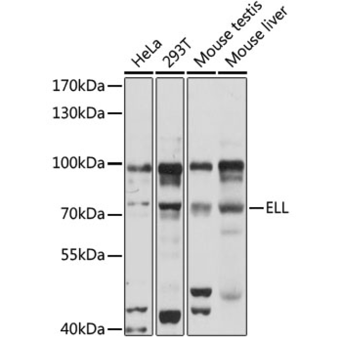 ELL Rabbit Polyclonal Antibody