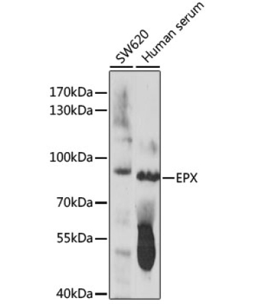 EPX Rabbit Polyclonal Antibody