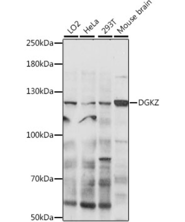 DGKZ Rabbit Polyclonal Antibody