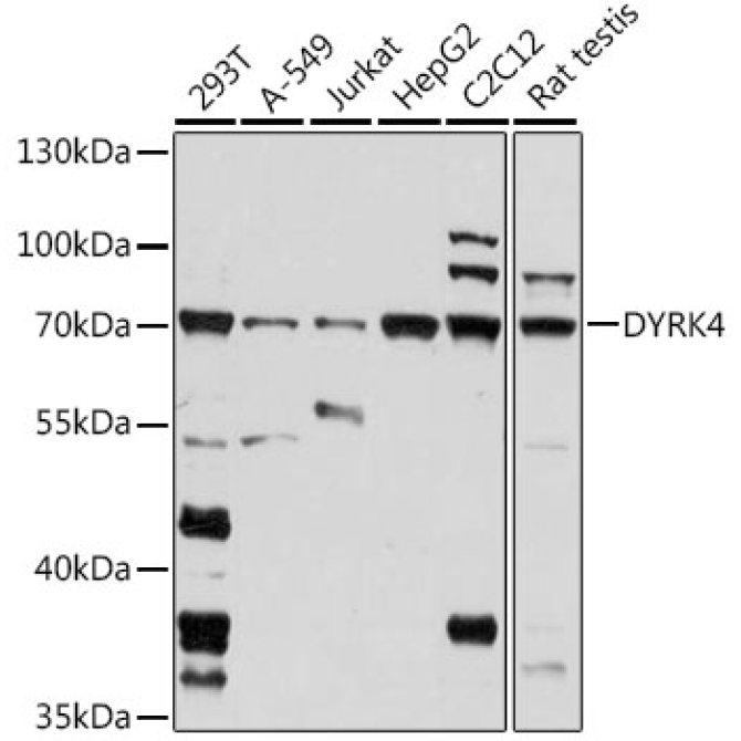 DYRK4 Rabbit Polyclonal Antibody