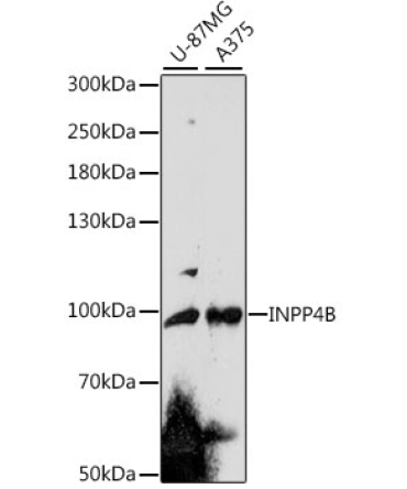 INPP4B Rabbit Polyclonal Antibody