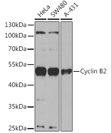Cyclin B2 Rabbit Polyclonal Antibody