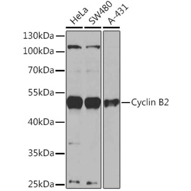 Cyclin B2 Rabbit Polyclonal Antibody