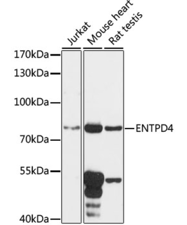 ENTPD4 Rabbit Polyclonal Antibody