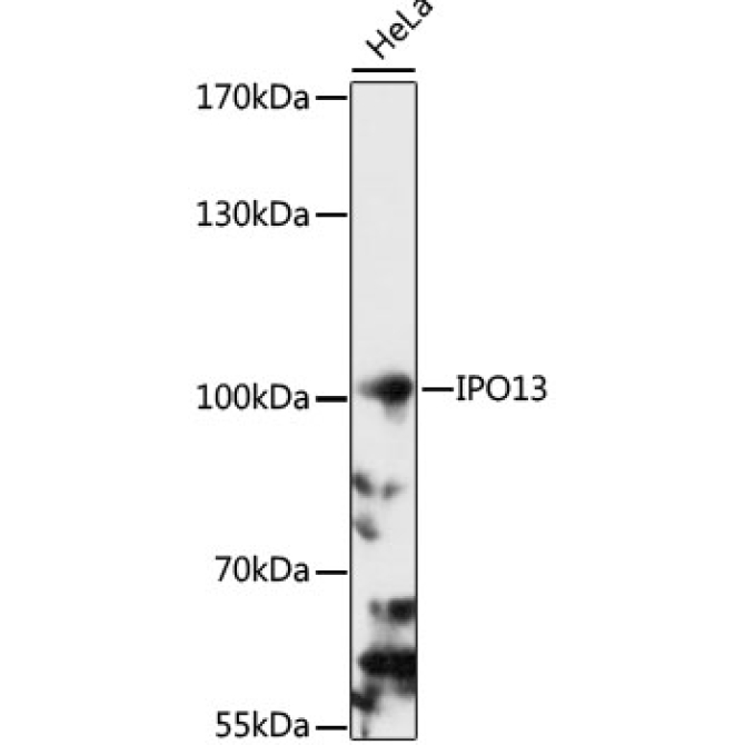 IPO13 Rabbit Polyclonal Antibody