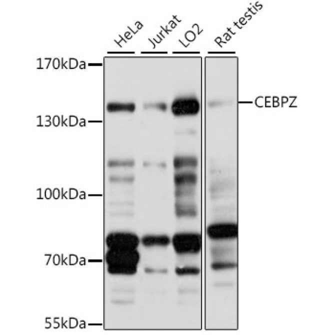 CEBPZ Rabbit Polyclonal Antibody