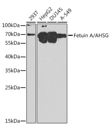 Fetuin A/AHSG Rabbit Polyclonal Antibody