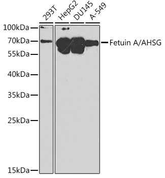 Fetuin A/AHSG Rabbit Polyclonal Antibody