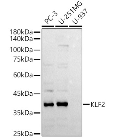 KLF2 Rabbit Polyclonal Antibody
