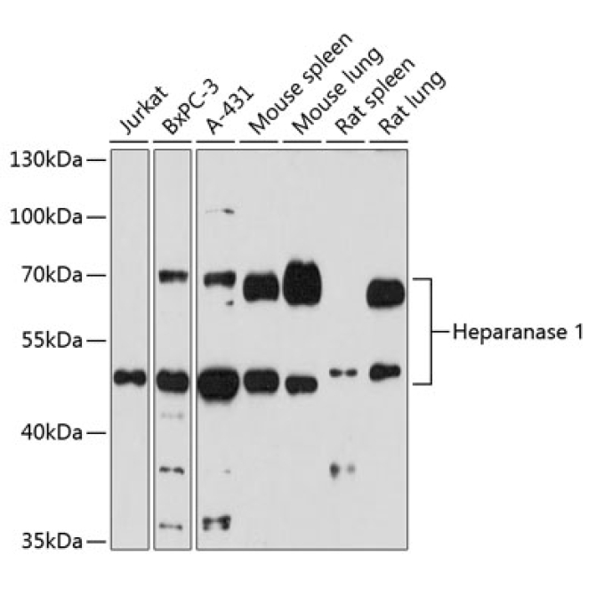 Heparanase 1 Rabbit Polyclonal Antibody