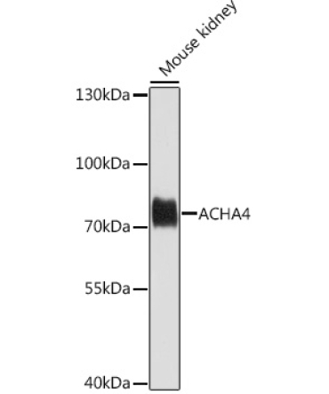 ACHA4 Rabbit Polyclonal Antibody