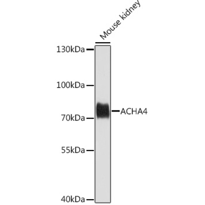 ACHA4 Rabbit Polyclonal Antibody