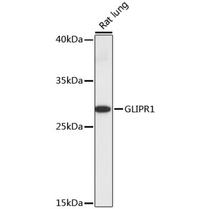 GLIPR1 Rabbit Polyclonal Antibody