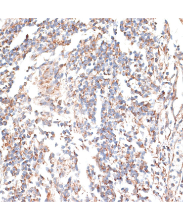 KATNA1 Rabbit Polyclonal Antibody