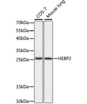 HEBP2 Rabbit Polyclonal Antibody