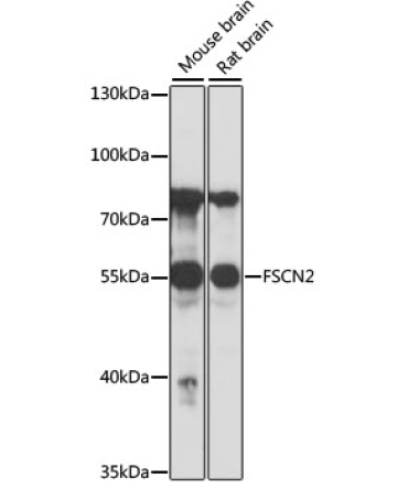 FSCN2 Rabbit Polyclonal Antibody