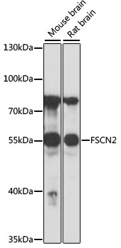 FSCN2 Rabbit Polyclonal Antibody