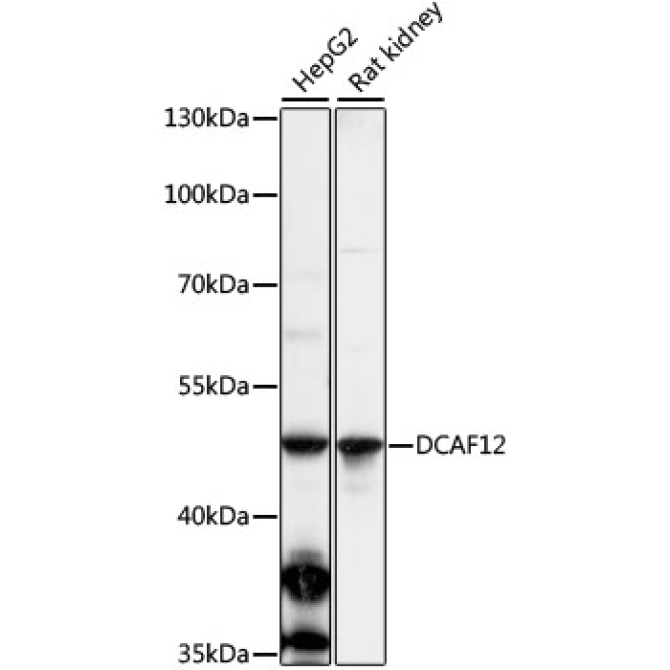 DCAF12 Rabbit Polyclonal Antibody