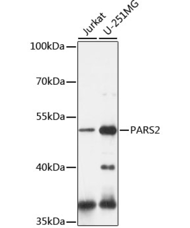 PARS2 Rabbit Polyclonal Antibody