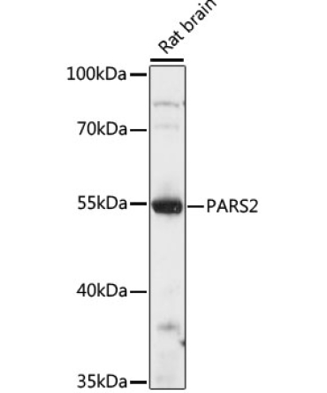 PARS2 Rabbit Polyclonal Antibody