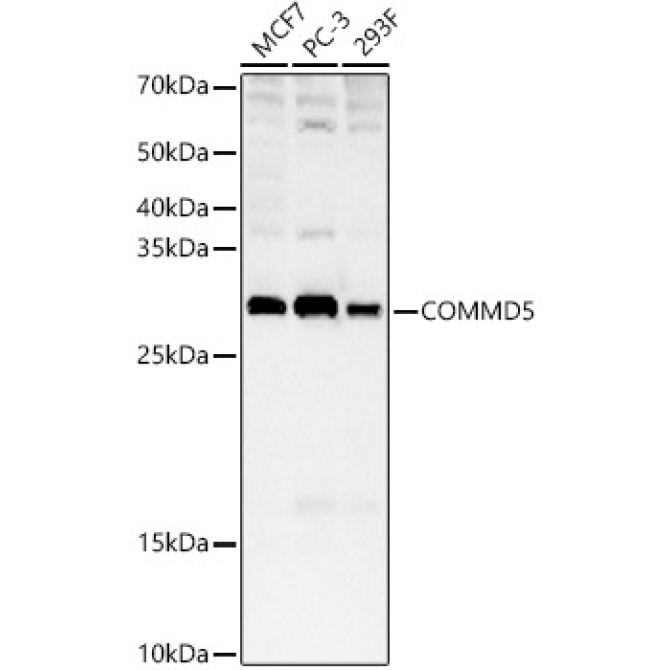 COMMD5 Rabbit Polyclonal Antibody