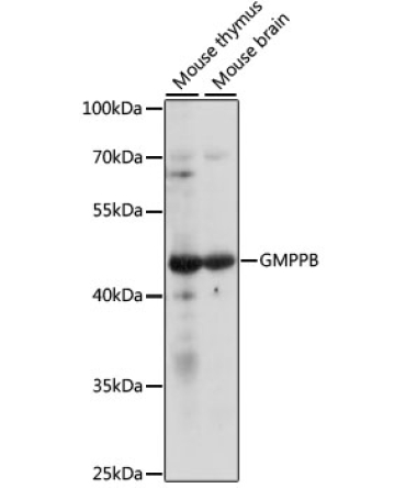GMPPB Rabbit Polyclonal Antibody
