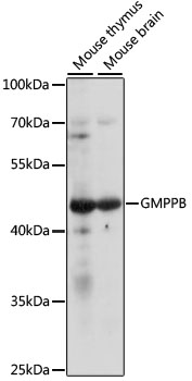 GMPPB Rabbit Polyclonal Antibody