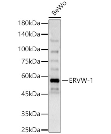 ERVW-1 Rabbit Polyclonal Antibody