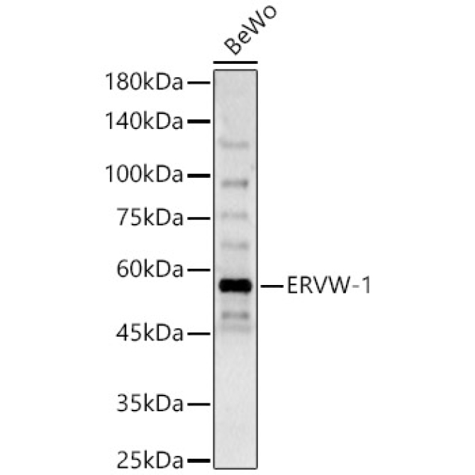 ERVW-1 Rabbit Polyclonal Antibody