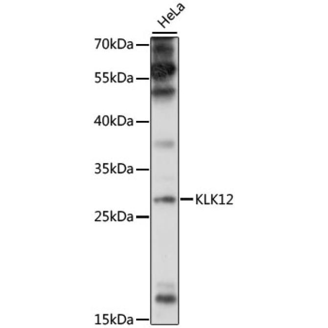 KLK12 Rabbit Polyclonal Antibody