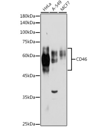 CD46 Rabbit Polyclonal Antibody