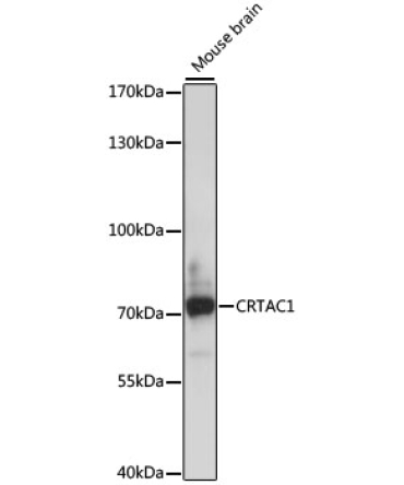 CRTAC1 Rabbit Polyclonal Antibody