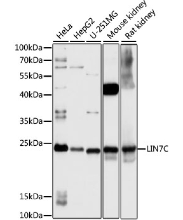 LIN7C Rabbit Polyclonal Antibody