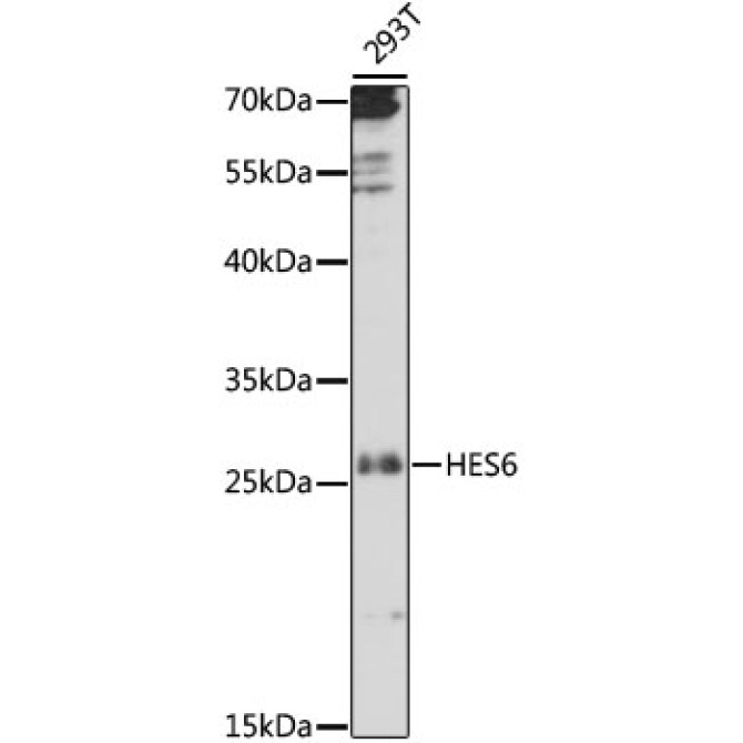 HES6 Rabbit Polyclonal Antibody