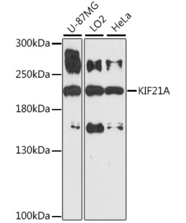 KIF21A Rabbit Polyclonal Antibody
